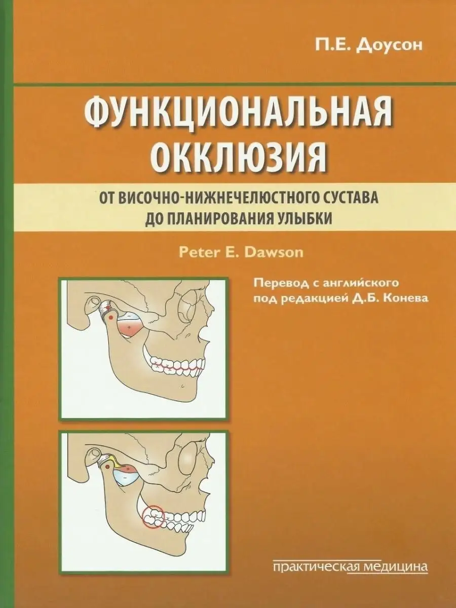 Функциональная окклюзия. Практическая медицина 14735067 купить в  интернет-магазине Wildberries