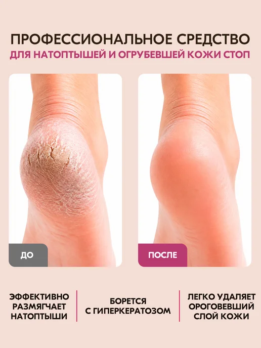 INKI Кератолитик для пяток профессиональный с мочевиной спрей, вариант, фото 2