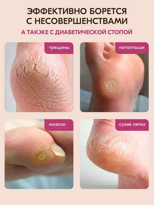 INKI Кератолитик для пяток профессиональный с мочевиной спрей, вариант, фото 6