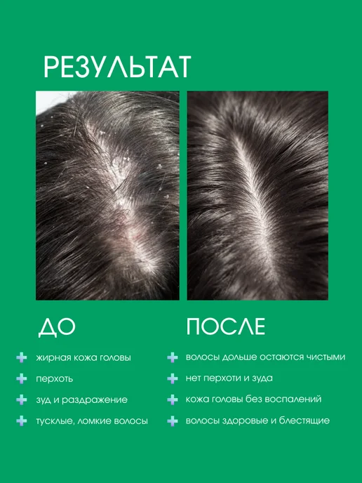 Sim Sensitive Шампунь от перхоти для жирных волос №1 250 мл System 4, 250 мл, фото 4