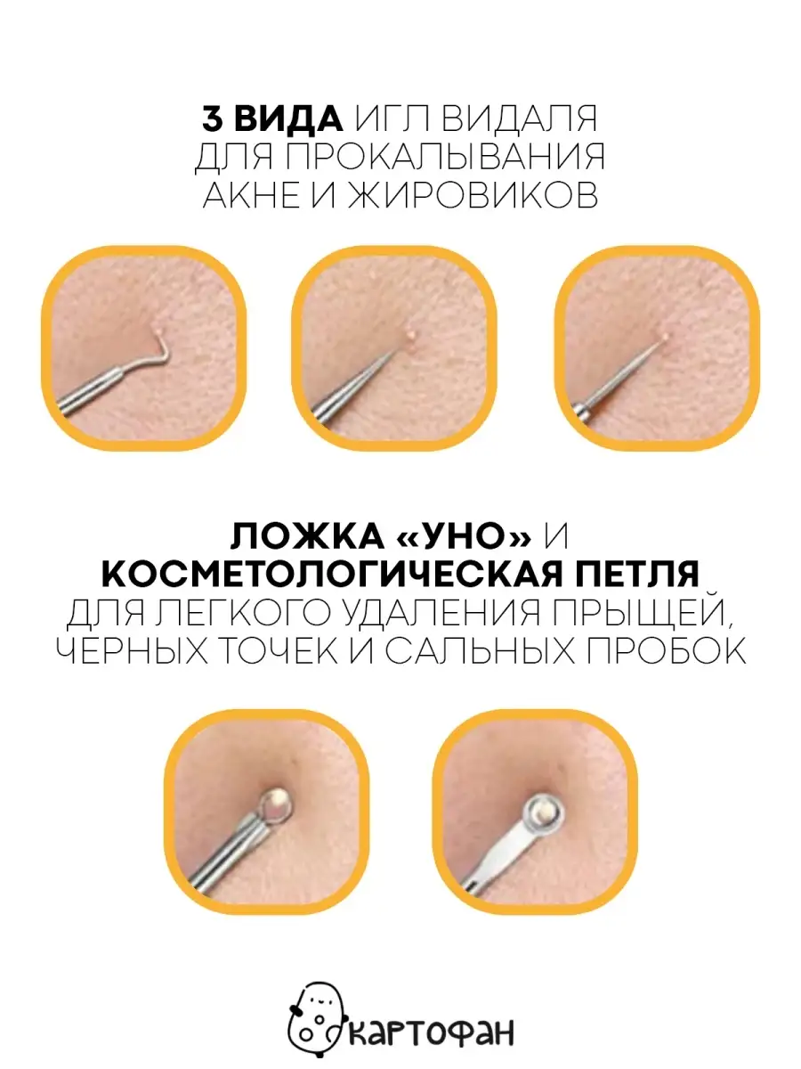 Палочка для удаления черных точек Etude House My Beauty Tool Pimple Popper - 1 шт.