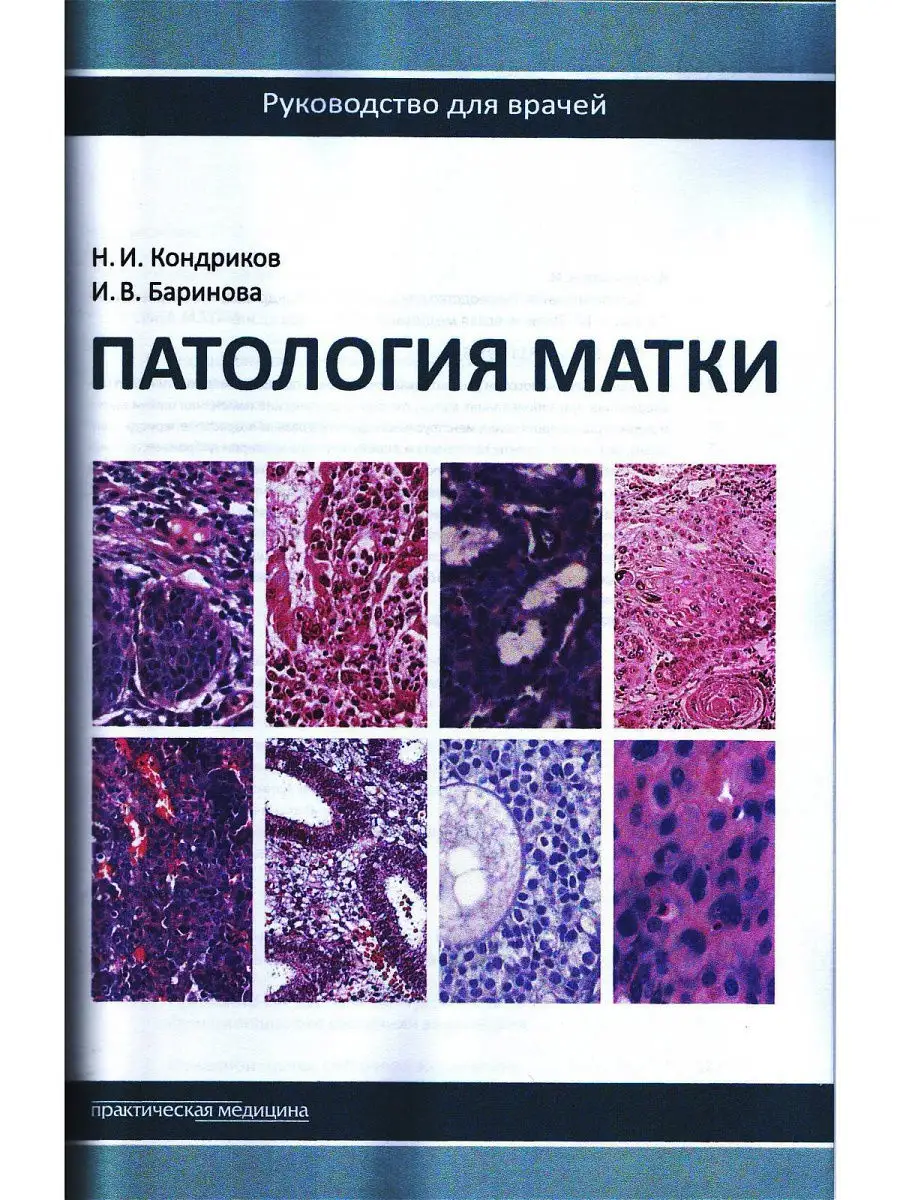 Патология матки. Руководство для врачей. Практическая медицина 15181089  купить за 1 515 ₽ в интернет-магазине Wildberries