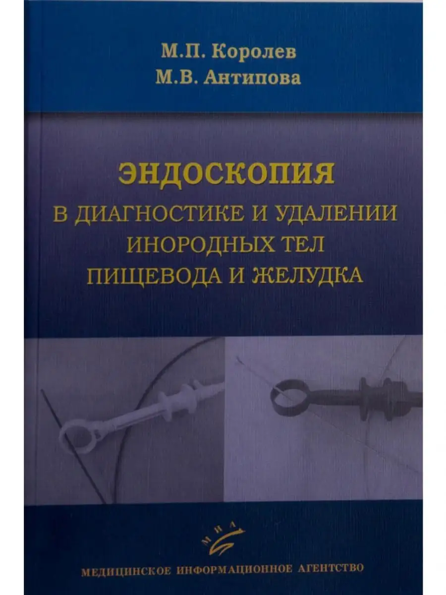 Эндоскопия в диагностике и удалении инор Медицинское информационное  агентство 15303177 купить за 401 ₽ в интернет-магазине Wildberries