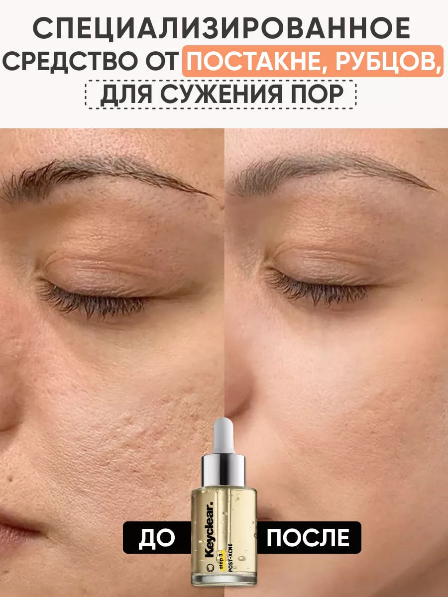 Уход для сужения пор на лице — купить в Москве по цене от 70 рублей | интернет-магазин Hollyshop
