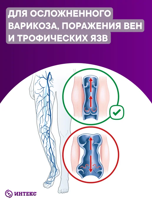 Интекс Бинт эластичный малой растяжимости 1,5мх8см, белый, фото 2