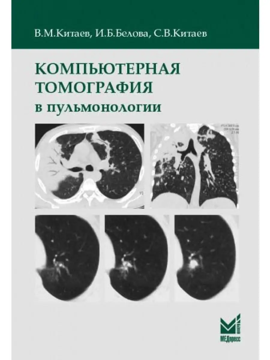 Компьютерная томография в пульмонологии МЕДпресс-информ 16828337 купить за  1 377 ₽ в интернет-магазине Wildberries