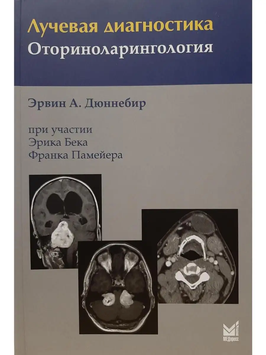 Лучевая Диагностика. Оториноларингология МЕДпресс-Информ 16828339.