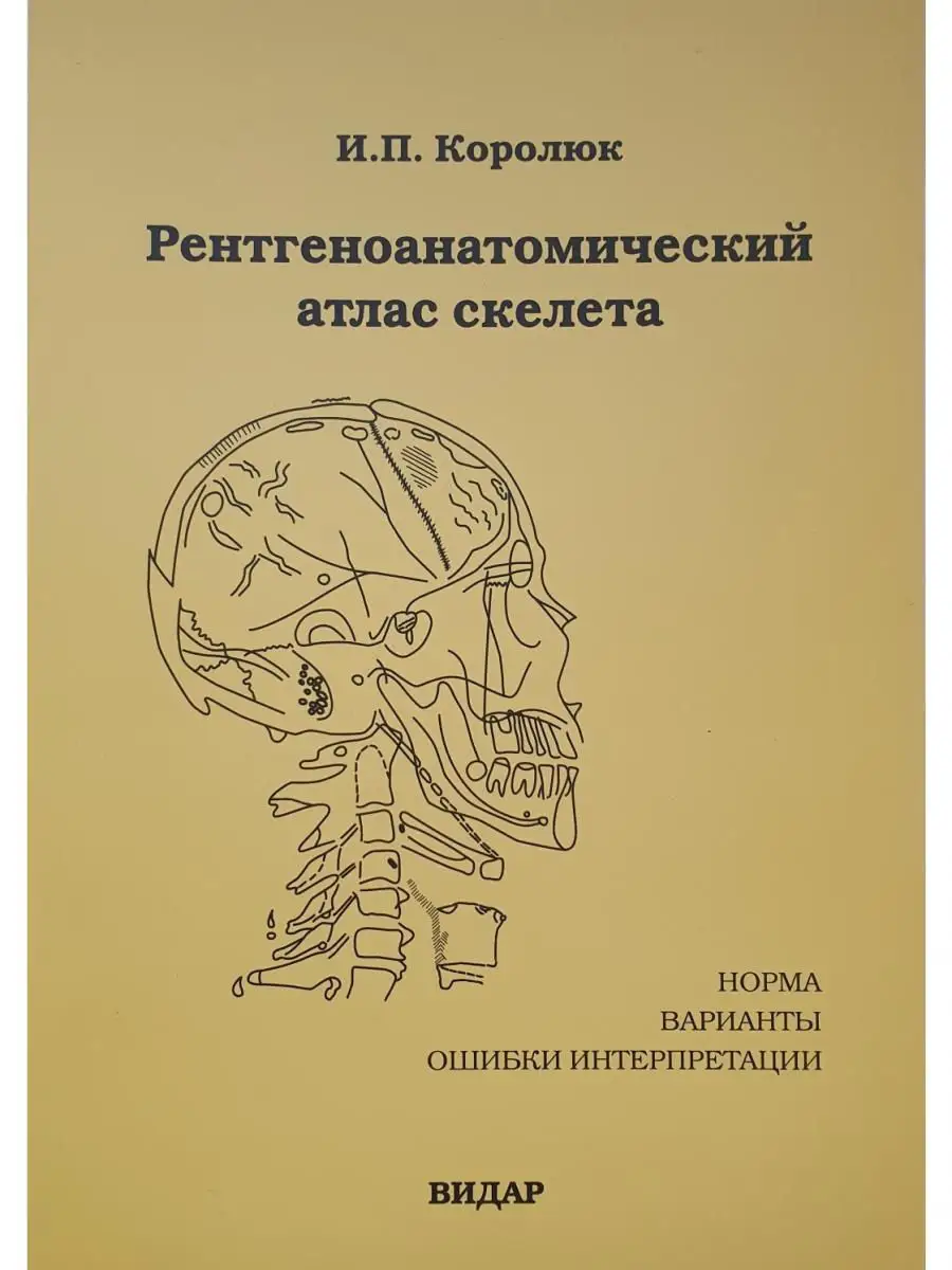 Рентгеноанатомический Атлас Скелета (Нор Видар 16831747 Купить За.