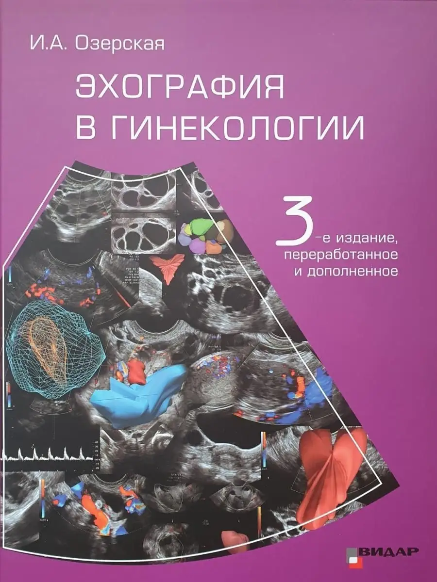 Эхография в гинекологии. Видар 16831780 купить за 5 668 ₽ в  интернет-магазине Wildberries