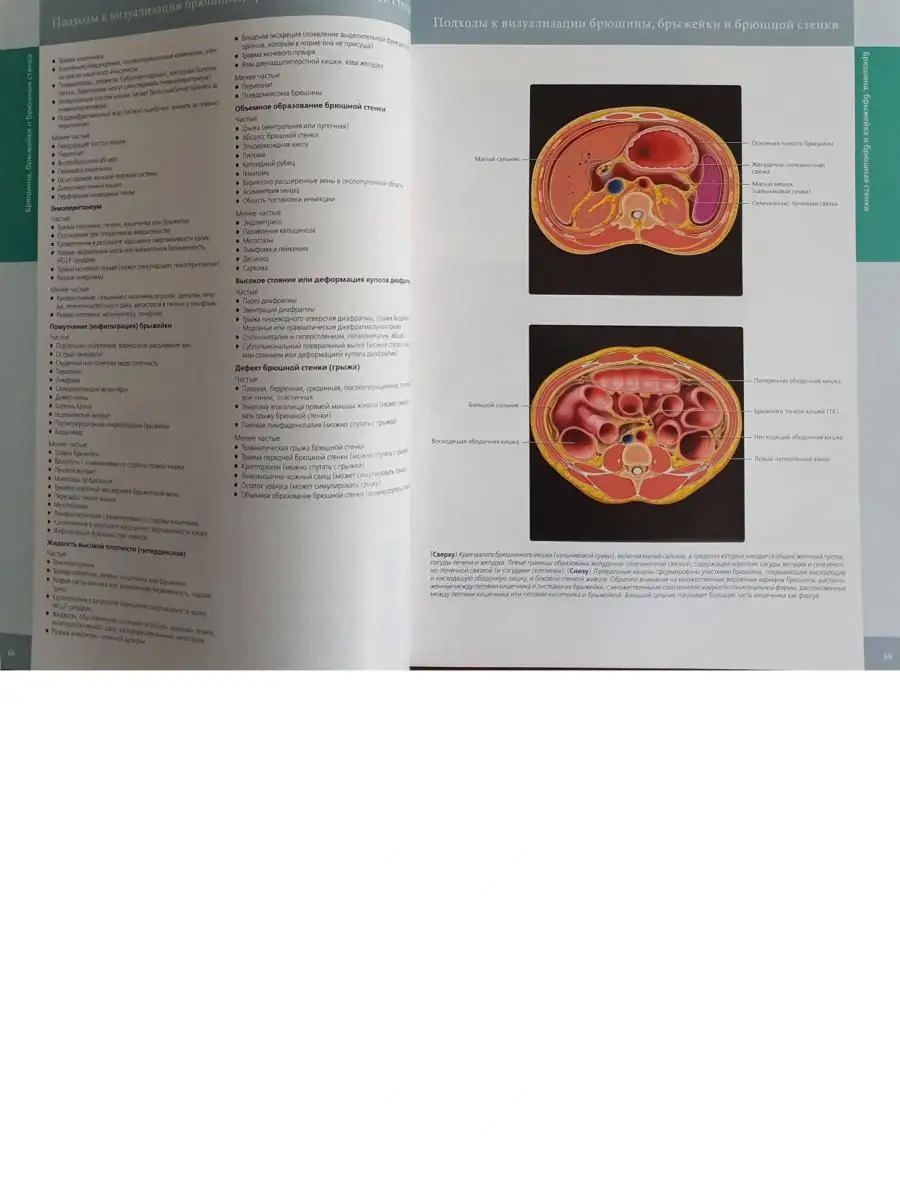 Лучевая диагностика. Органы брюшной Издательство Панфилова 16848204 купить  за 8 523 ₽ в интернет-магазине Wildberries