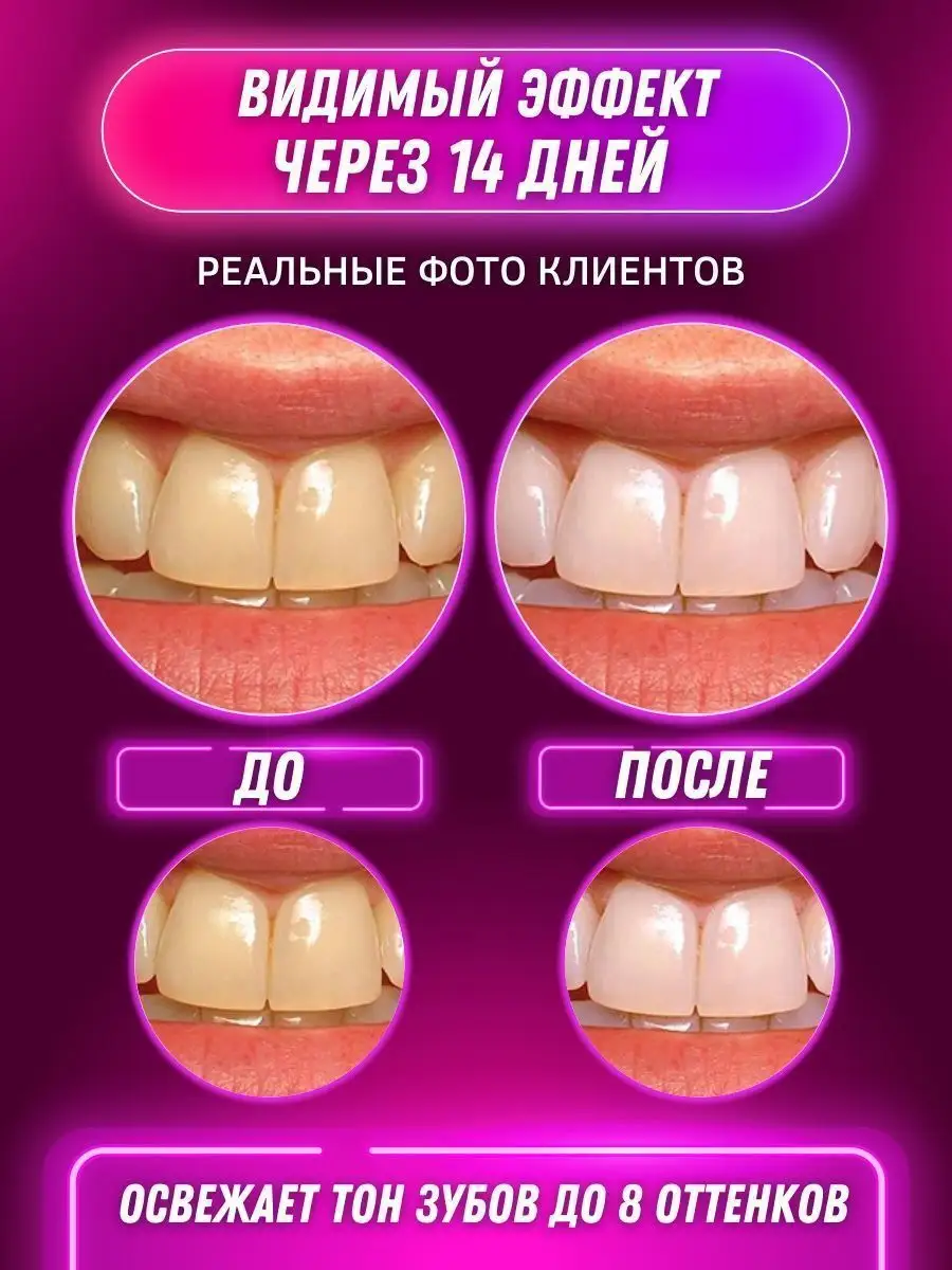 Dreamx Beauty Капа для отбеливания зубов