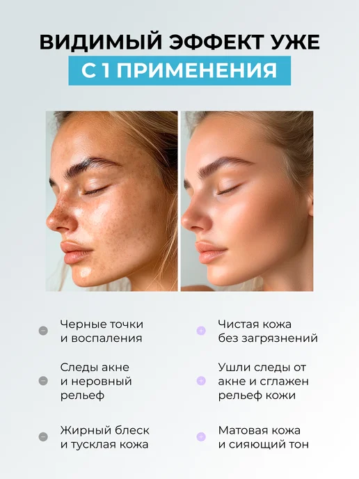 MISHA KISS Энзимный гель пилинг скатка для лица, 140 мл, фото 2