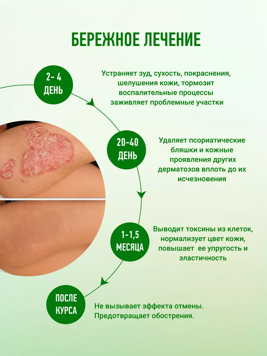 Мазь от псориаза эффективная Акрустал 17185053 купить за 763 ₽ в  интернет-магазине Wildberries