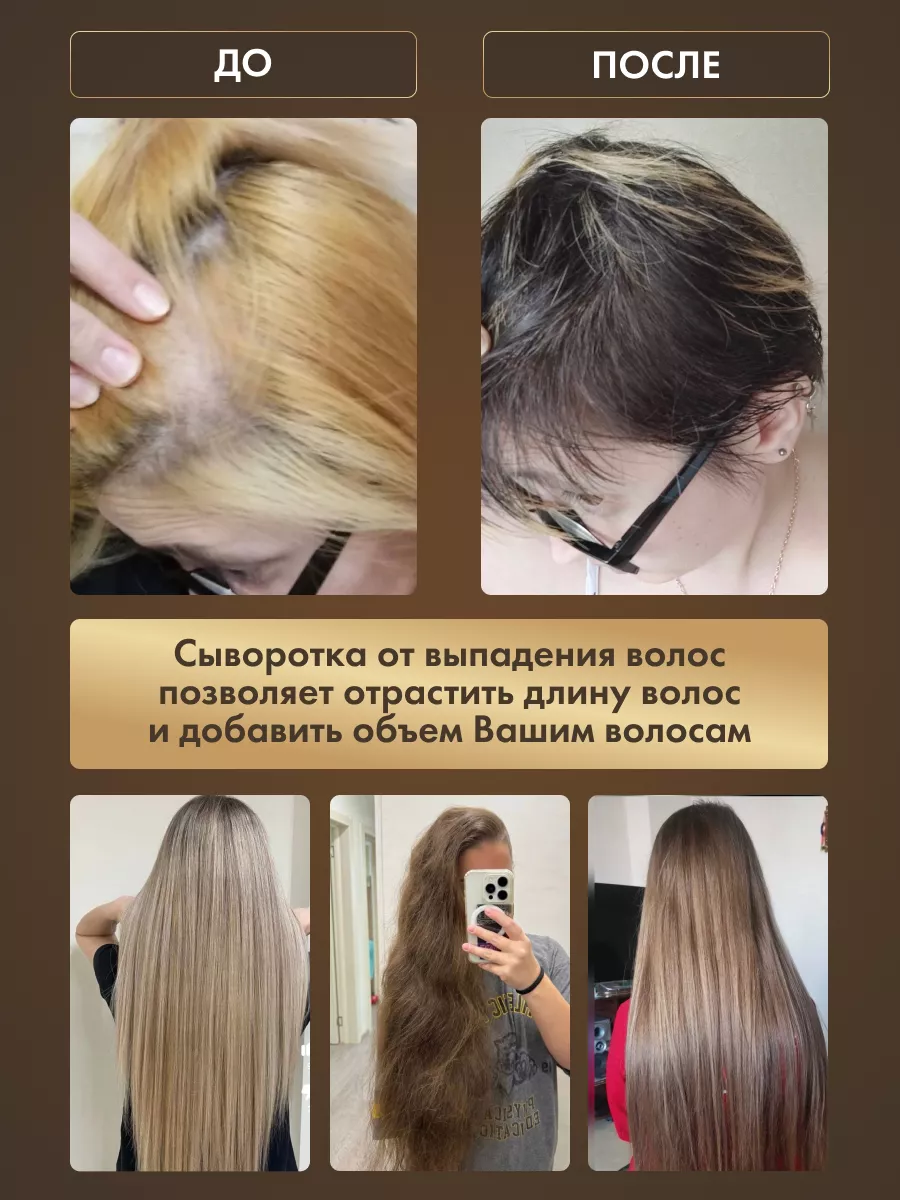 Сыворотка для роста против выпадения Wellness your hair 17651807 купить за  419 ₽ в интернет-магазине Wildberries