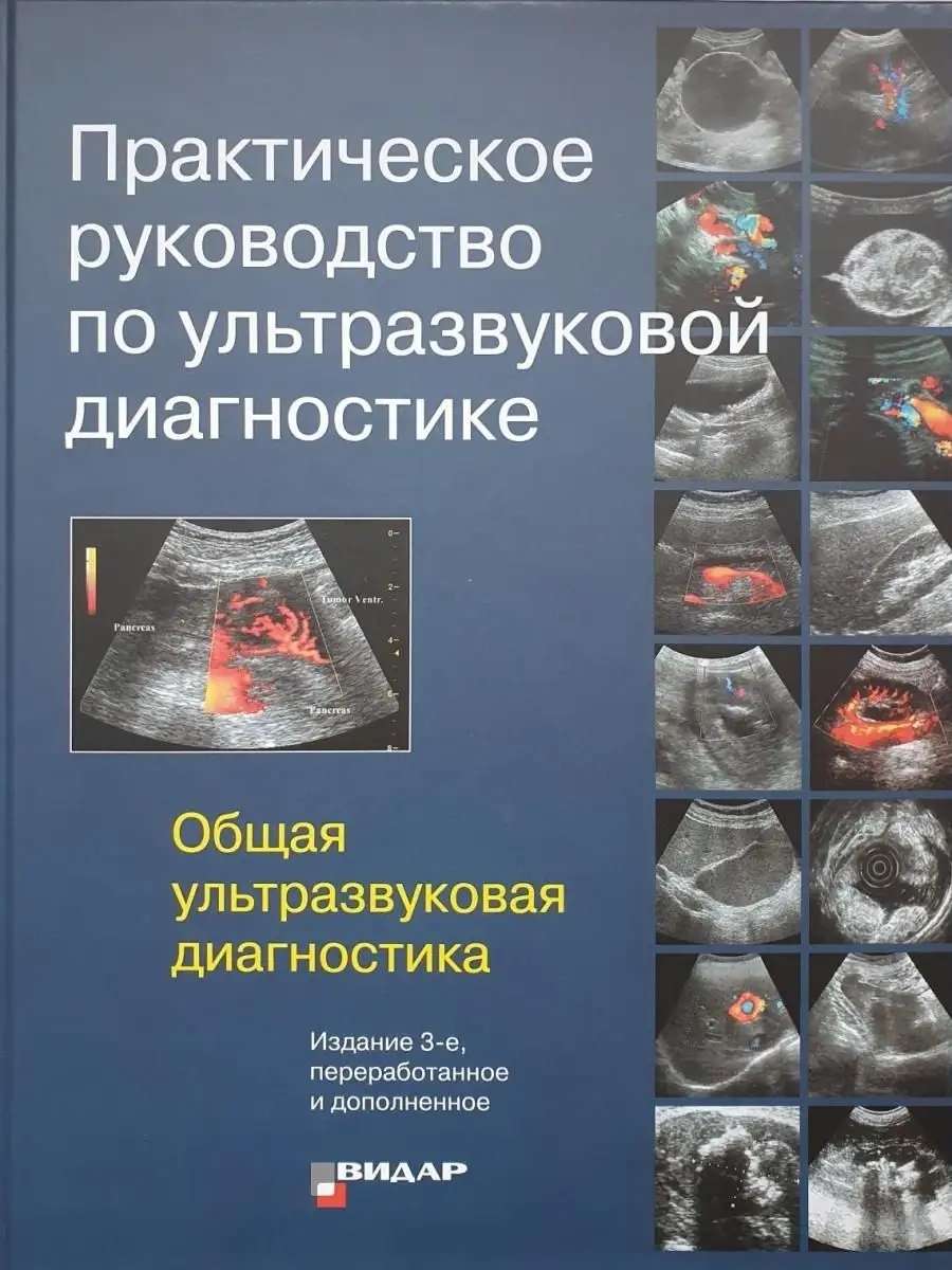 Практическое руководство по ультразвуков Видар 18169185 купить за 6 460 ₽ в  интернет-магазине Wildberries