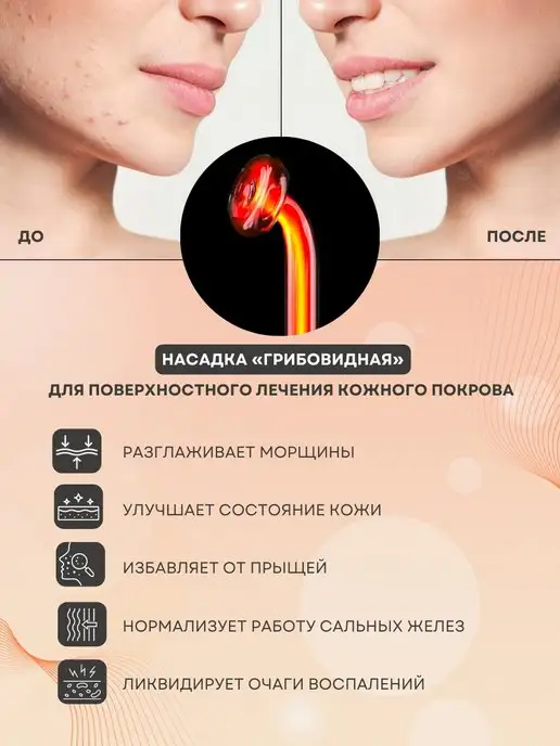 Карат Дарсонваль ДЕ212 Медицинский профессиональный, вариант, фото 3