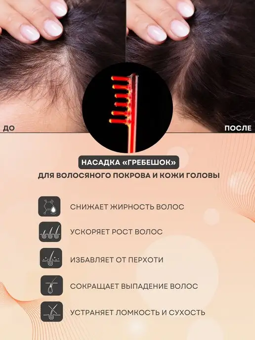 Карат Дарсонваль ДЕ212 Медицинский профессиональный, вариант, фото 4