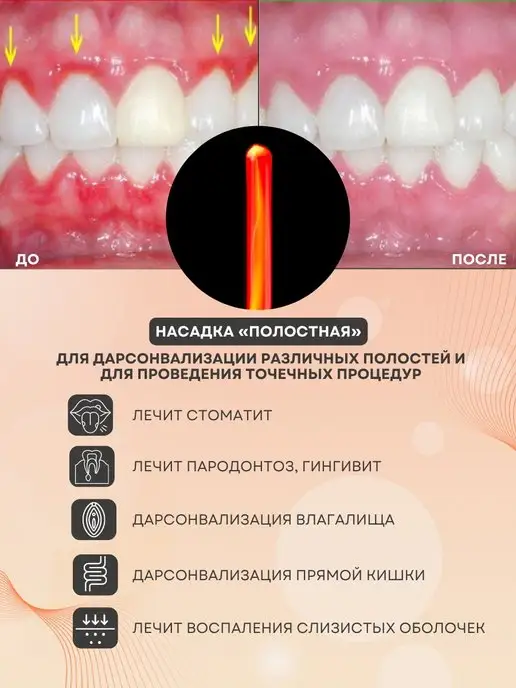 Карат Дарсонваль ДЕ212 Медицинский профессиональный, вариант, фото 5