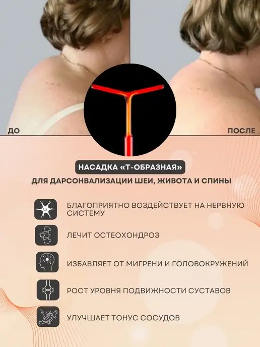Карат Дарсонваль ДЕ212 Медицинский профессиональный, вариант, фото 6