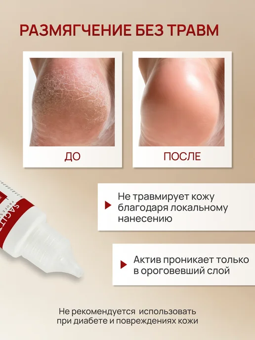 Sagitta professional Кератолитик для удаления мозолей интенсивный, 30 мл, 30 мл, фото 3