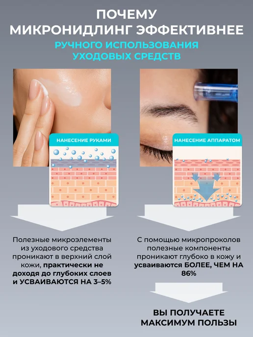 Mezonica Картридж для дермапен мезопен DraMes Насадка на 24 иглы 3 шт, 3 шт, фото 6