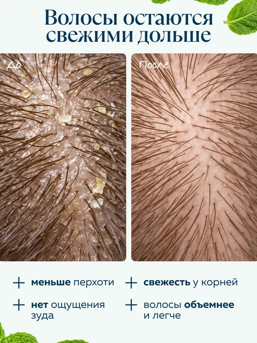 mi&ko Шампунь от перхоти для жирных волос бессульфатный, 200 мл, фото 2