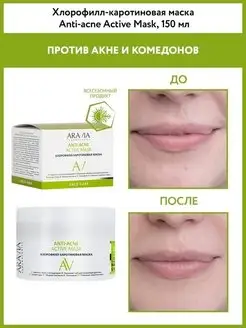 Хлорофилл-каротиновая маска Anti-Acne Active Mask, 150 мл ARAVIA Laboratories 19462343 купить за 556 ₽ в интернет-магазине Wildberries