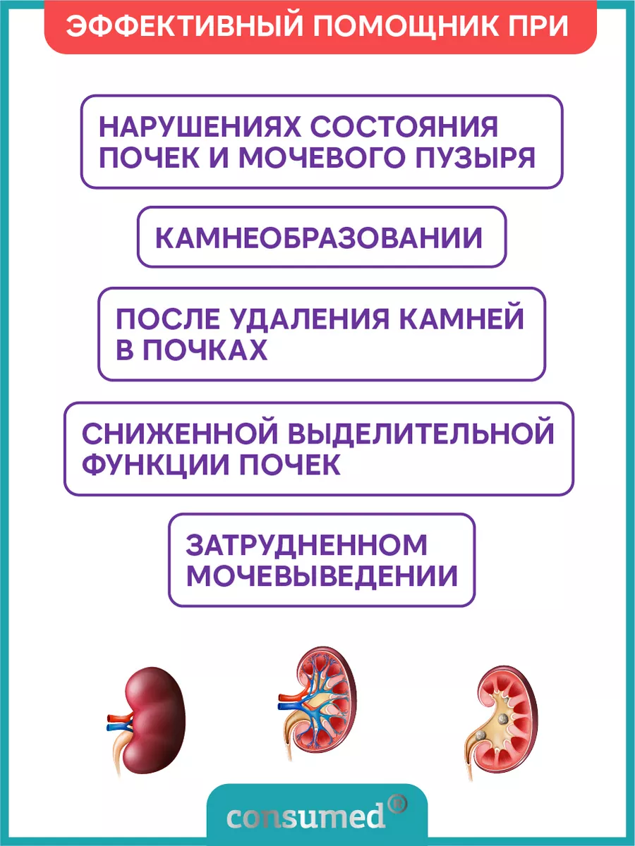 Комплекс для мочевыводящих путей 60 таб. Consumed 21420237 купить за 468 ₽  в интернет-магазине Wildberries