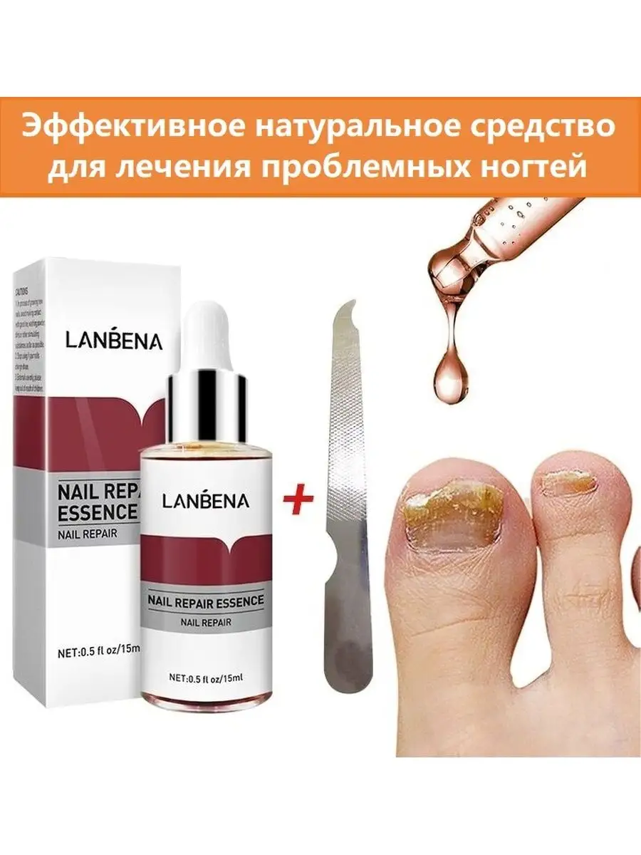 Эссенция для лечения грибка ногтей LANBENA 22935713 купить в  интернет-магазине Wildberries