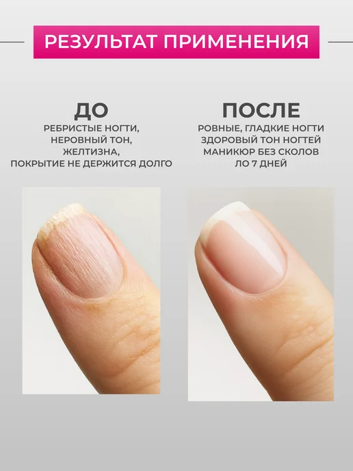 Sophin Лак база для выравнивания и укрепления ногтей, 12 мл, 12 мл, фото 8
