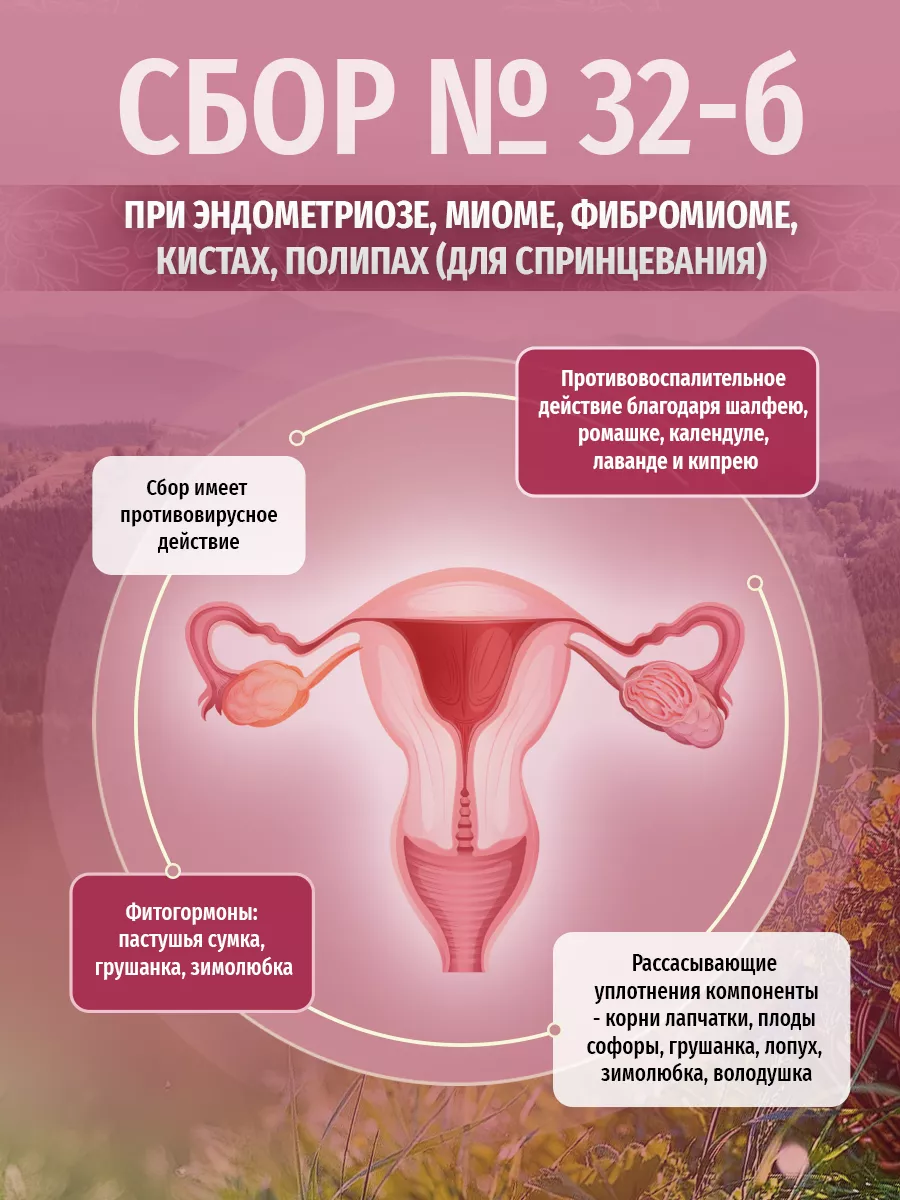 Травяной сбор № 32-б чай при эндометриозе, миоме, фибромиоме Травы Кавказа  26451218 купить в интернет-магазине Wildberries