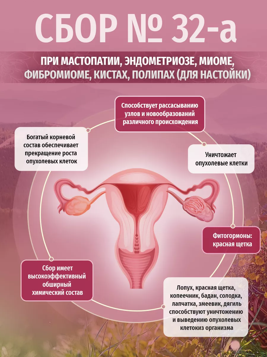 Травяной сбор № 32-а, Сбор при мастопатии (для настойки) Травы Кавказа  26451309 купить за 1 091 ₽ в интернет-магазине Wildberries