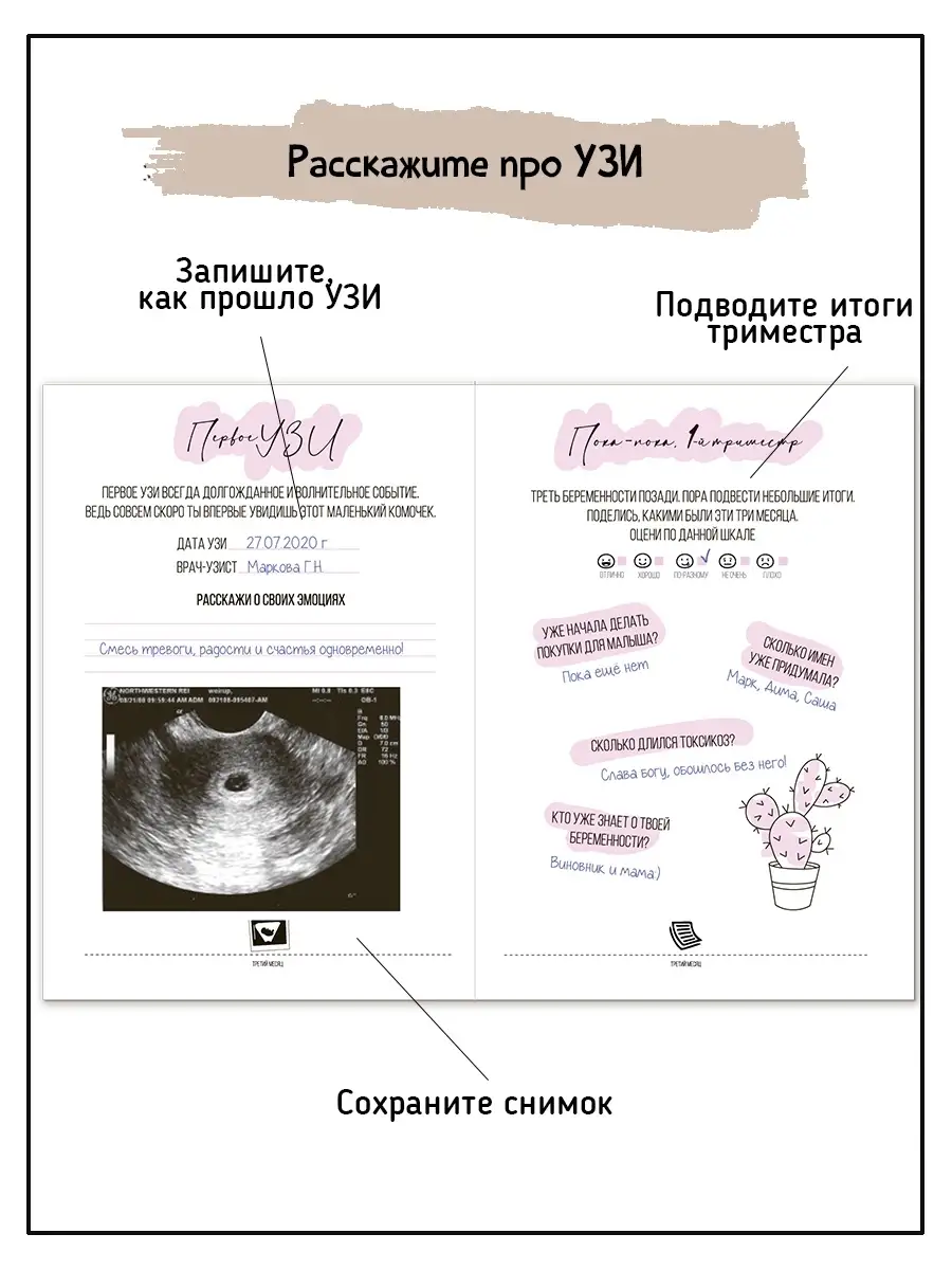 УЗИ при беременности в Казани от рублей