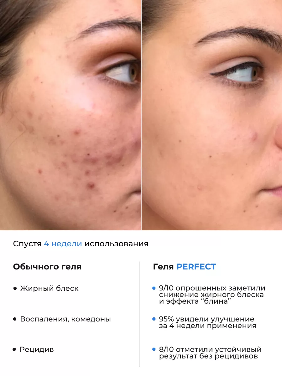 Гель для умывания с кислотами BHA Prosto Cosmetics 27103881 купить за 1 180  ₽ в интернет-магазине Wildberries