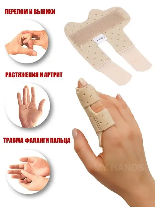 Лечение перелома пальца руки - Статья