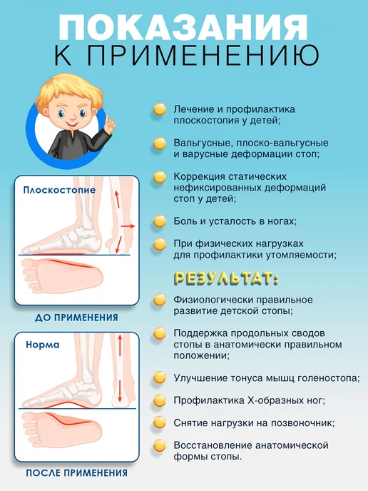 Trives Ортопедические стельки при плоскостопии для детей вальгусные, синий, фото 5