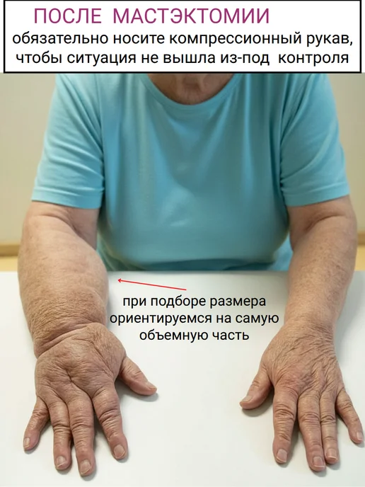 центр компресс Компрессионный рукав с перчаткой, бежевый, фото 6