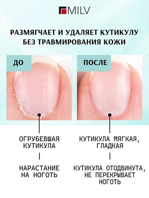 MILV Ремувер для удаления кутикулы с мочевиной, вариант, фото 2