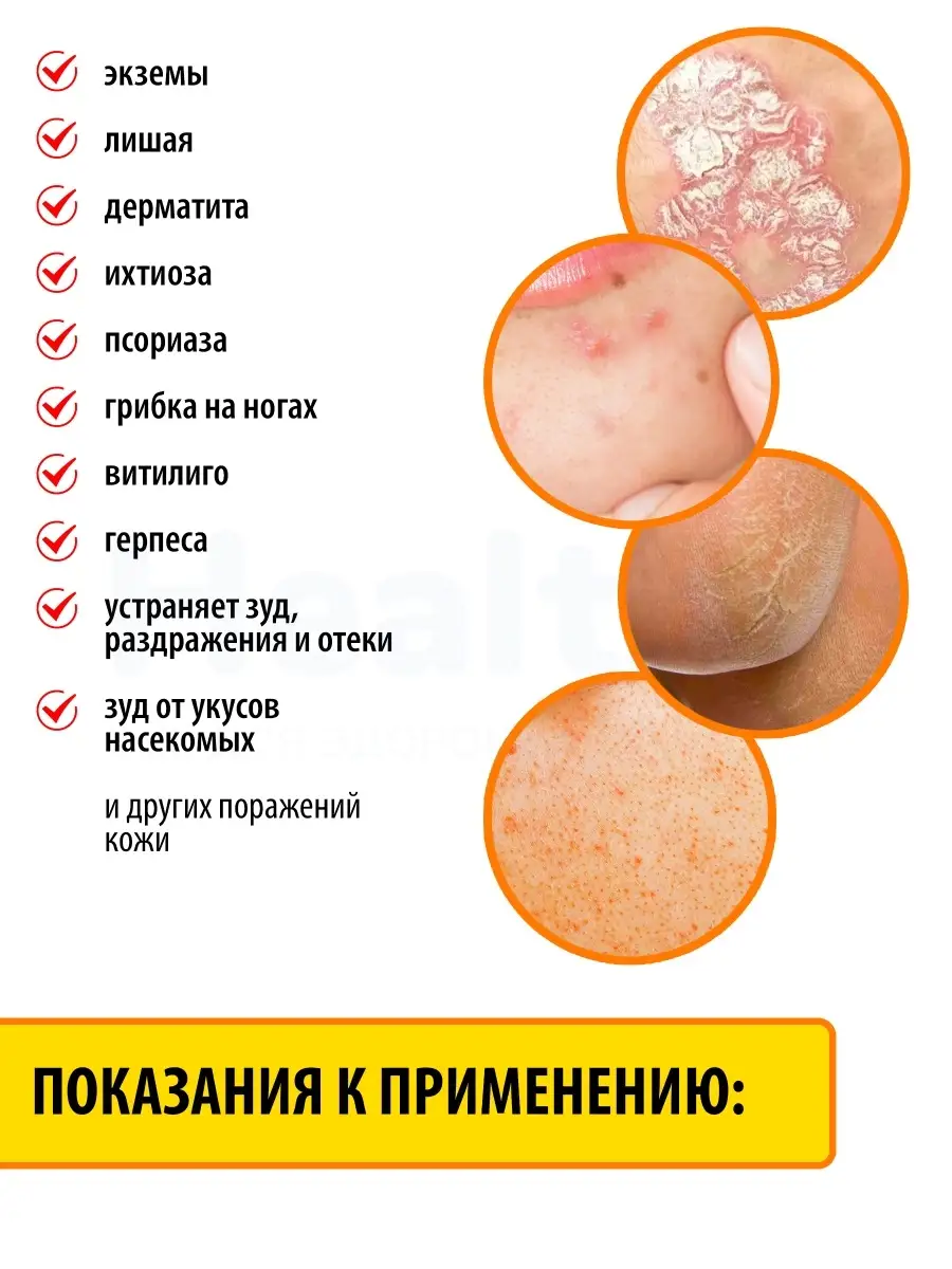 Китайская чудо мазь от псориаза и дерматита Yiganerjing Pifu 4HEALTH  28674904 купить за 211 ₽ в интернет-магазине Wildberries